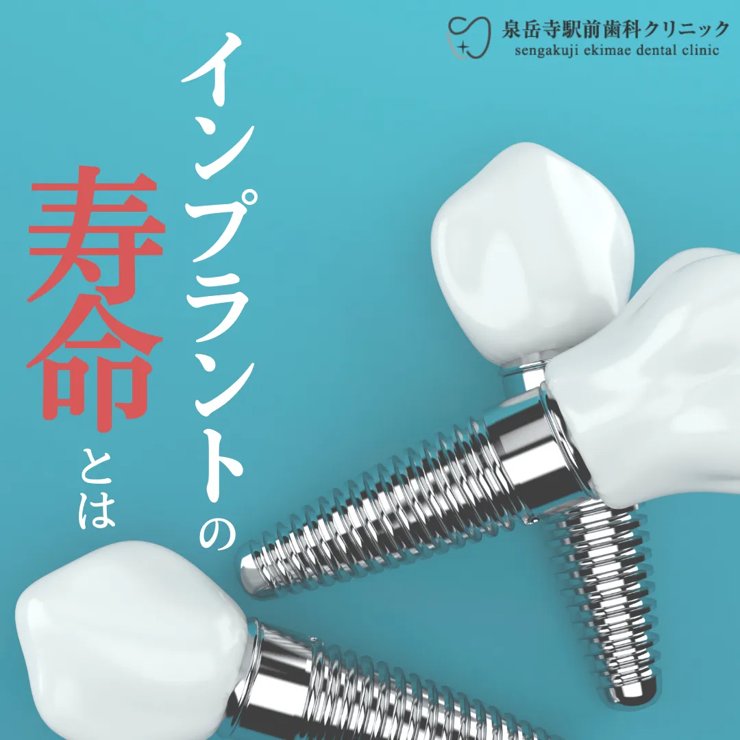 インプラントの寿命とは？
