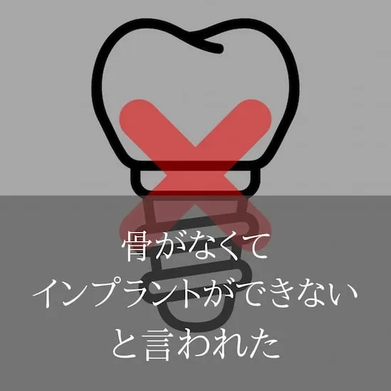 インプラント治療